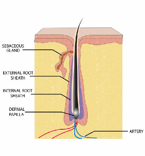 Is electrolysis hair removal permanent