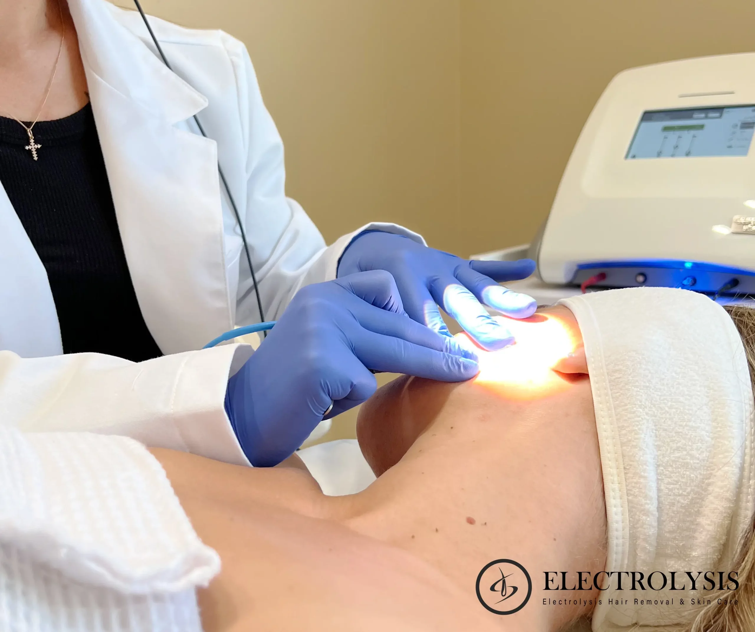 Electrolysis Hair Removal for PCOS Chicago | 100% Permanent