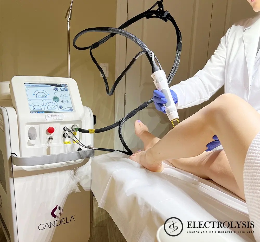 Electrolysis hair 2024 removal service