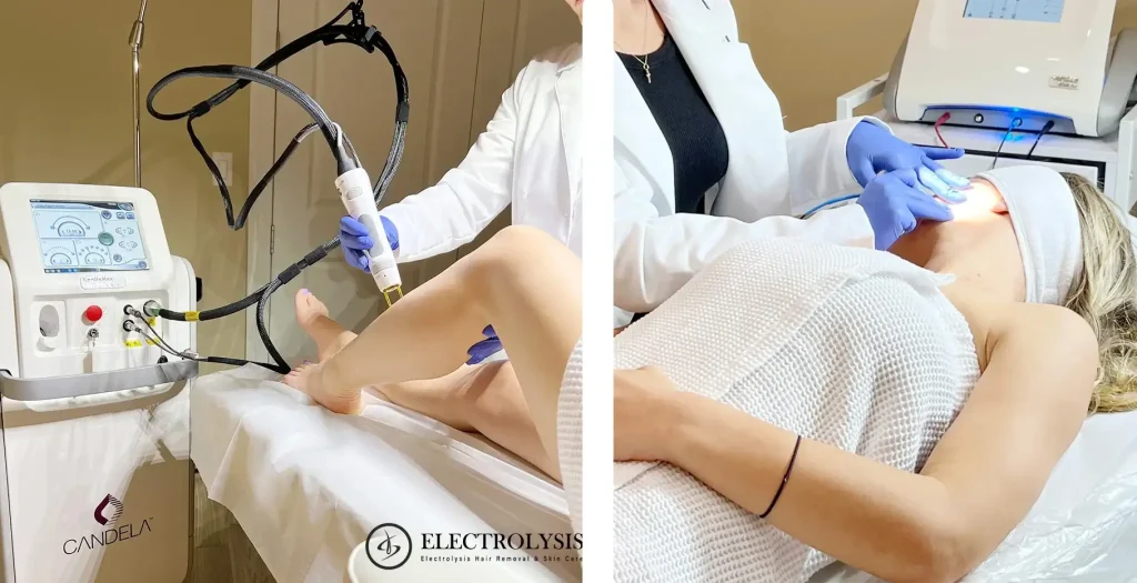 Laser First, Then Electrolysis: How We Combine Both for Trans Hair Removal