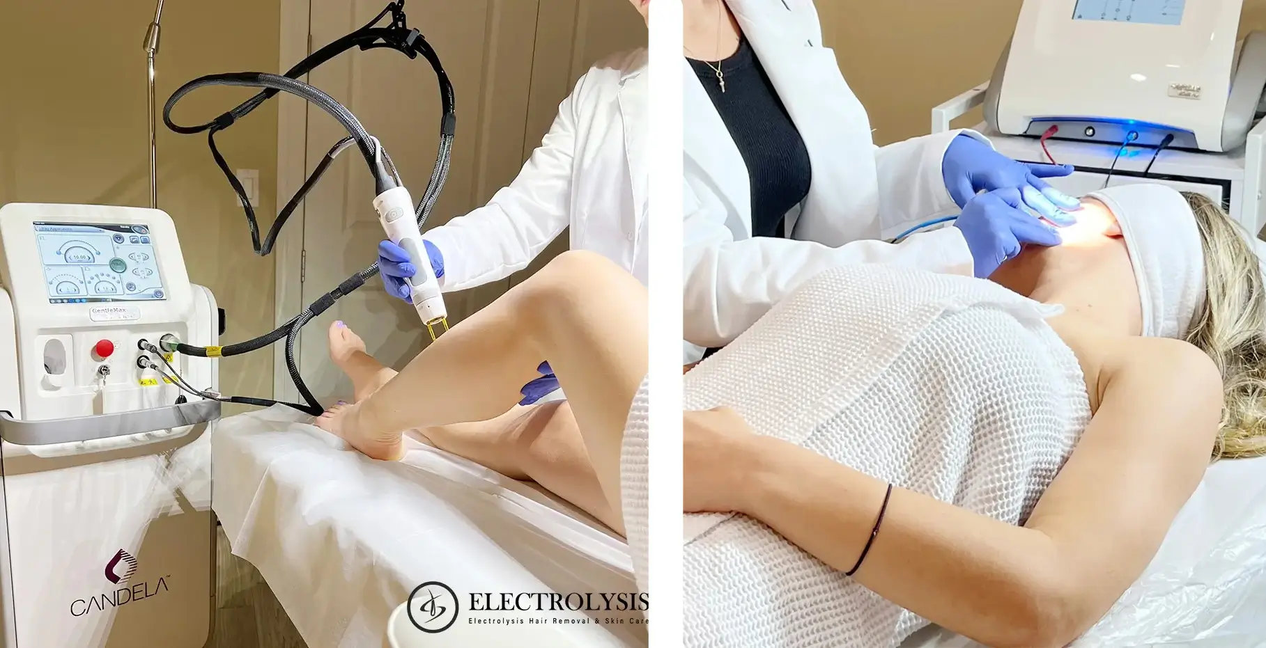 Laser First, Then Electrolysis: How We Combine Both for Trans Hair Removal