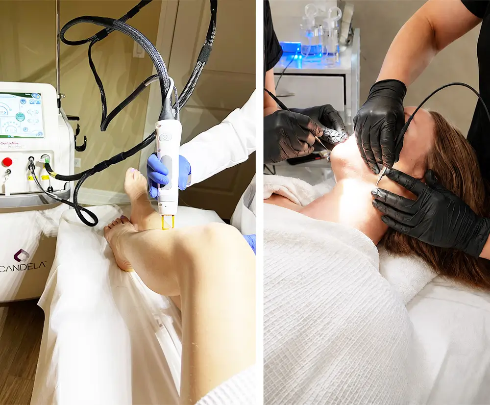 Combining laser hair removal and electrolysis for transgender permanent hair removal in Chicago