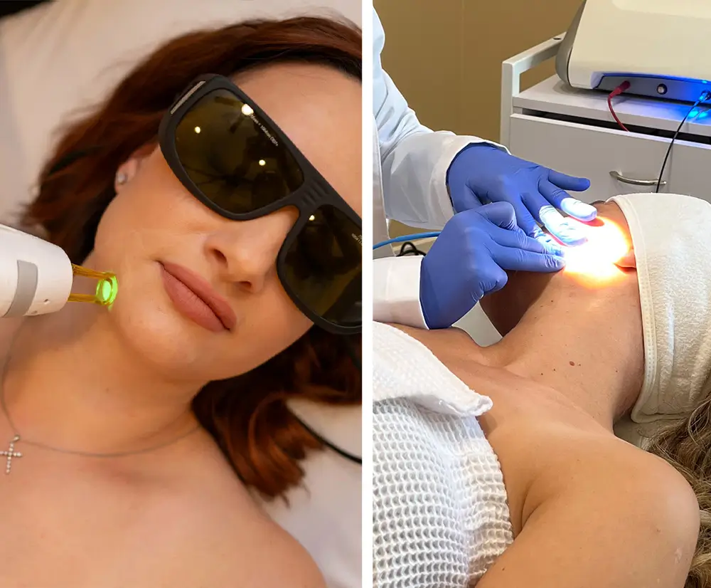 Laser and electrolysis hair removal in Chicago